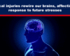 Expose News: Brain diagram highlights how physical injuries rewire our brains, influencing our stress response. Discover the surprising connection!